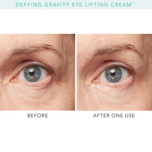 red light therapy for under eye circles
