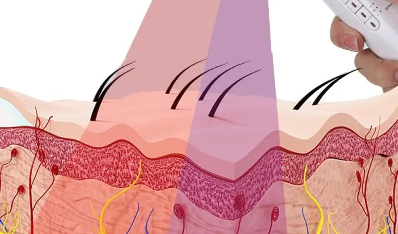 Red Light Therapy For Wrinkles : Before And After 28 infrared light heat on skin