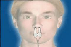 Intranasal device for various applications on brain healthand sinus