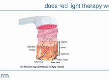 red light therapy on skin