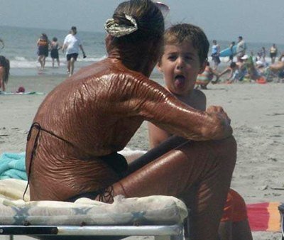 Can You Go On A Sunbed With Peeling Skin